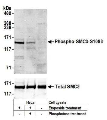 Western Blot: SMC3 [p Ser103] Antibody [NBP2-37694]